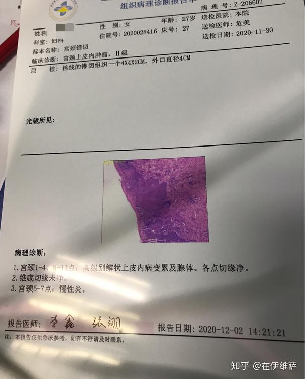 hpv cin2冷刀锥切