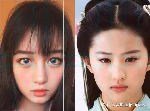 成都谭超为什么有人割了双眼皮也不好看
