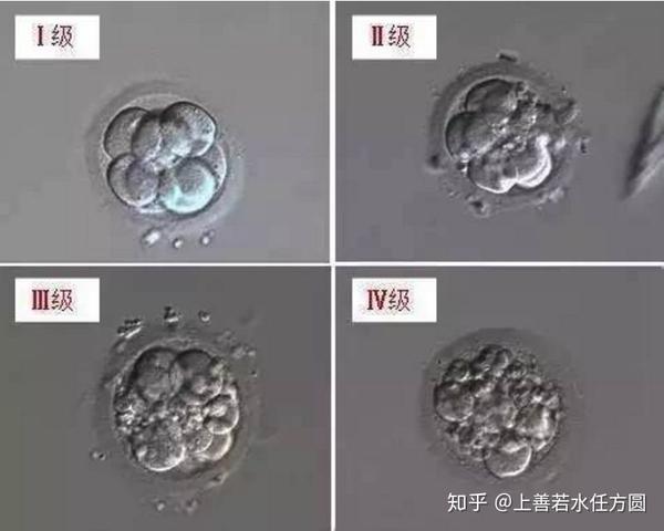 对不起,丑拒!胚胎的世界里颜值也是硬通货