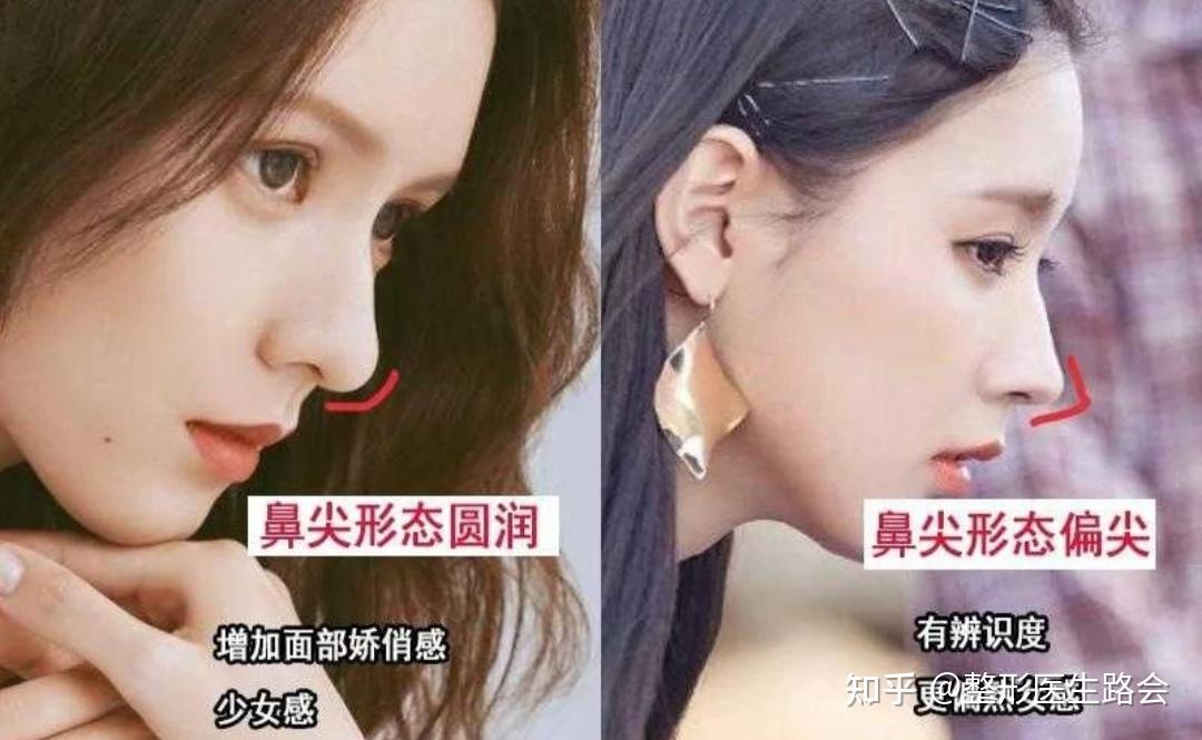 直鼻,翘鼻,微驼峰,好看的鼻子有很多,哪种的更适合我?
