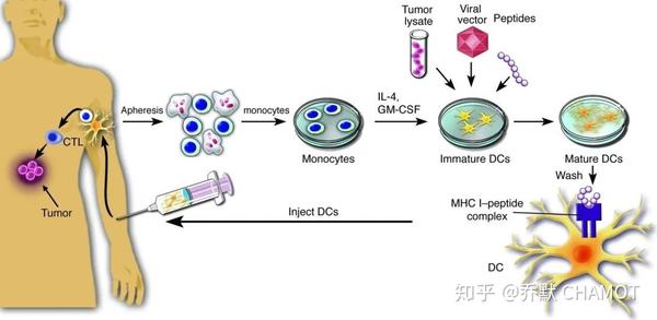 dc细胞治疗流程图