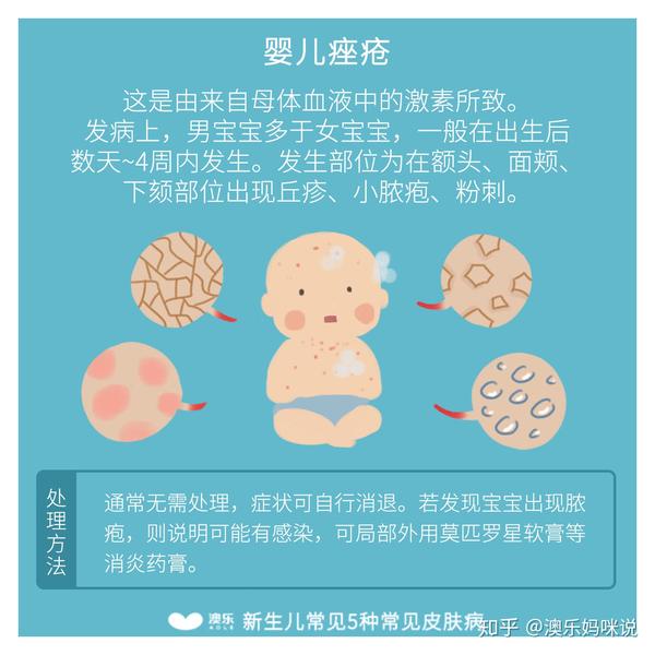 警惕!新生儿这5种常见皮肤病