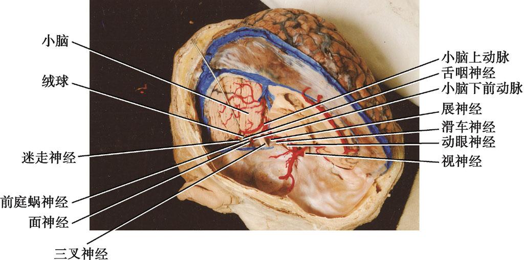 第二节 脑桥小脑角 - 神经外科锁孔手术 - 知乎书店
