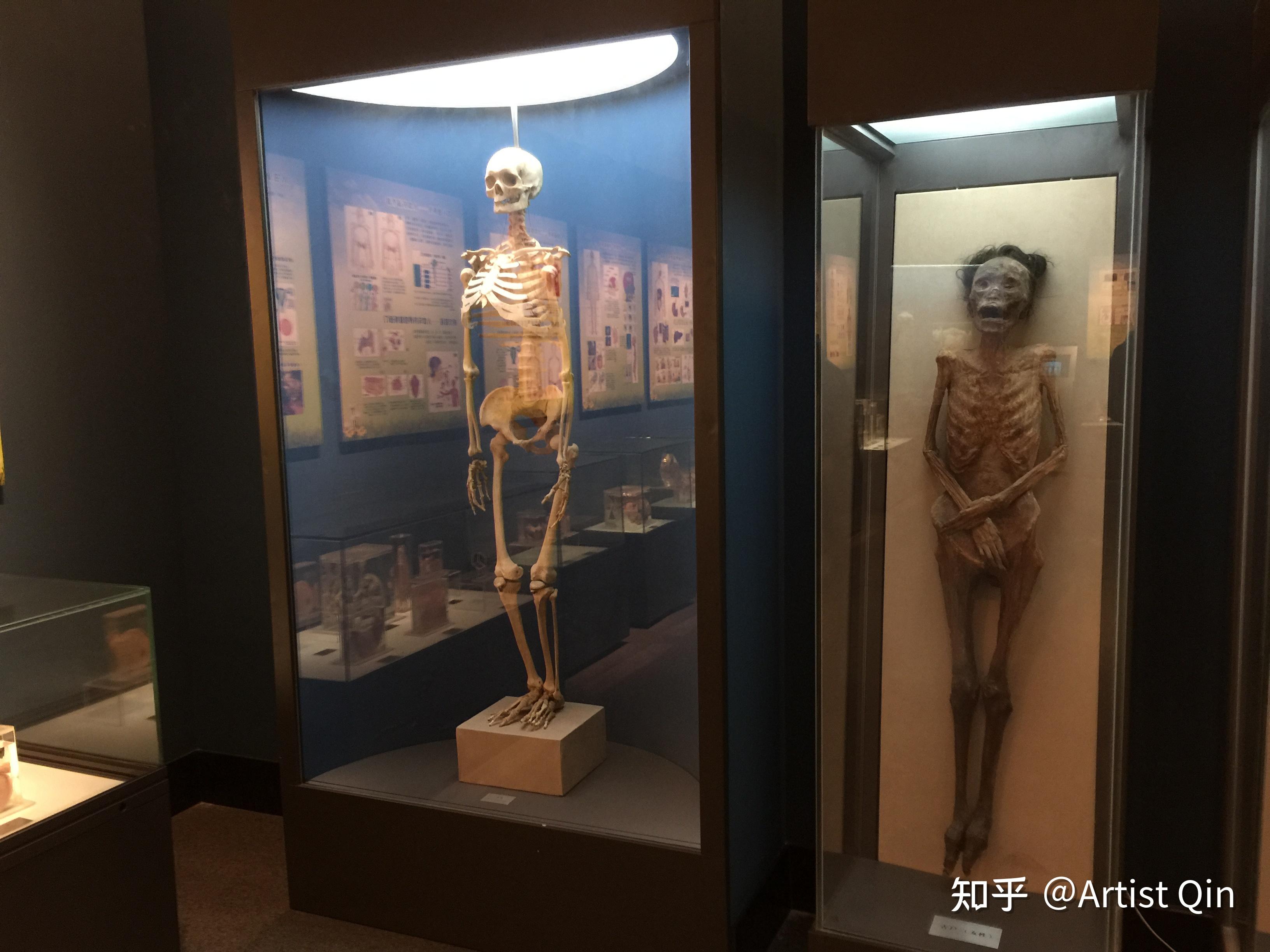 杭州自然博物馆里的人体标本是真的吗