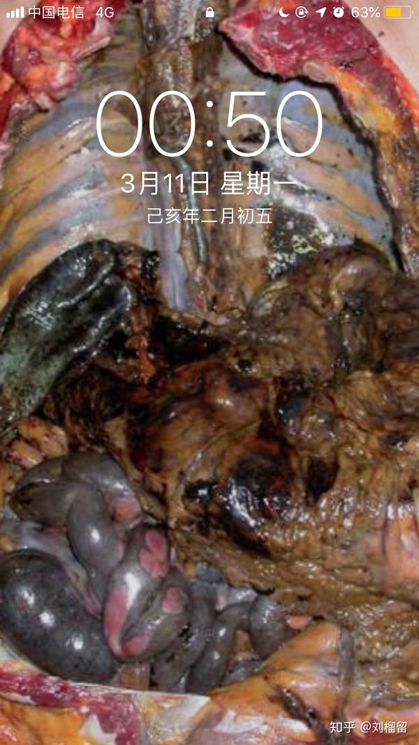 网上看的图(侵删),戒烟用.