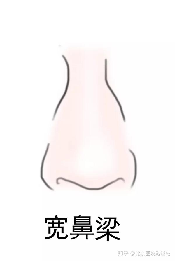 常见七种不完美鼻型,快进来看你属于哪一种