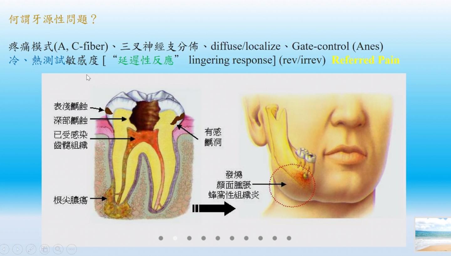 牙体牙髓研讨会陈志平施德氏根管治疗