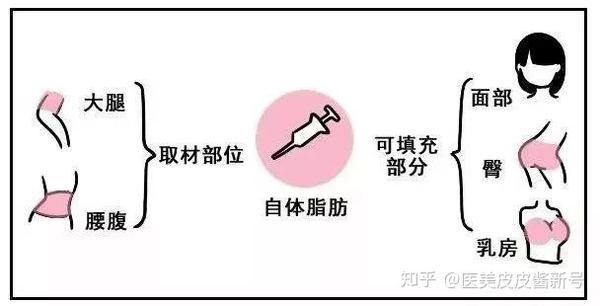 在不考虑价格的情况下,玻尿酸填充和自体脂肪填充哪个