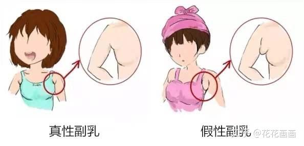 胸部下垂,副乳,外扩?求求你别再瞎穿内衣了!