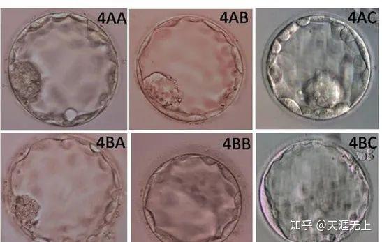 试管婴儿囊胚一共分几级?哪个等级更好?