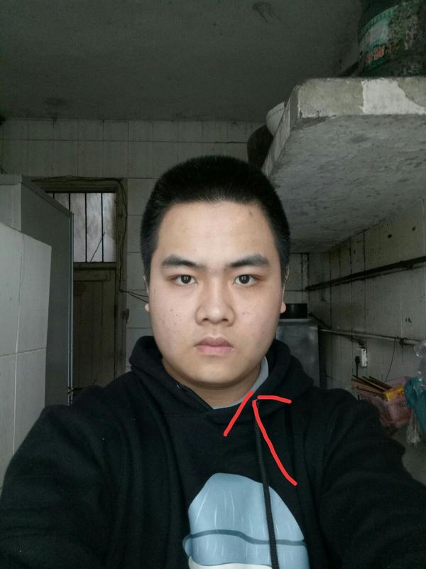 脸歪是吗怎么办