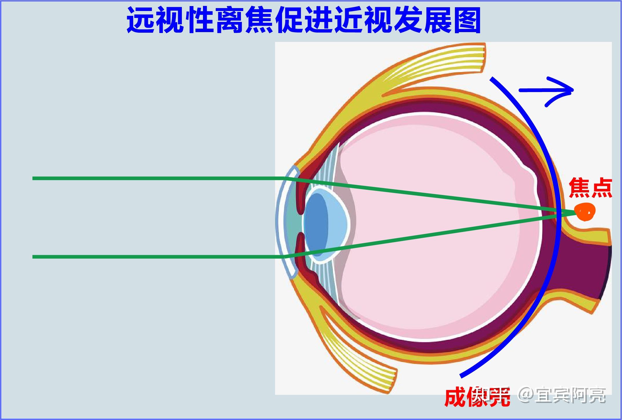 新一代多点复合离焦伟星星乐视也是不错的选择