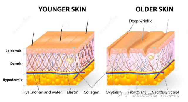 这是因为在肌肤的真皮层里,会有胶原蛋白,弹力蛋白,透明质酸共同构建