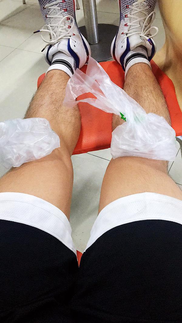 青春期男生腿毛旺盛过去青春期之后会变正常吗?