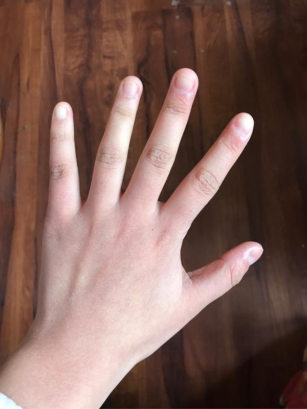 女生的手长得比男生还丑,又短又粗是怎样一种体验 ?