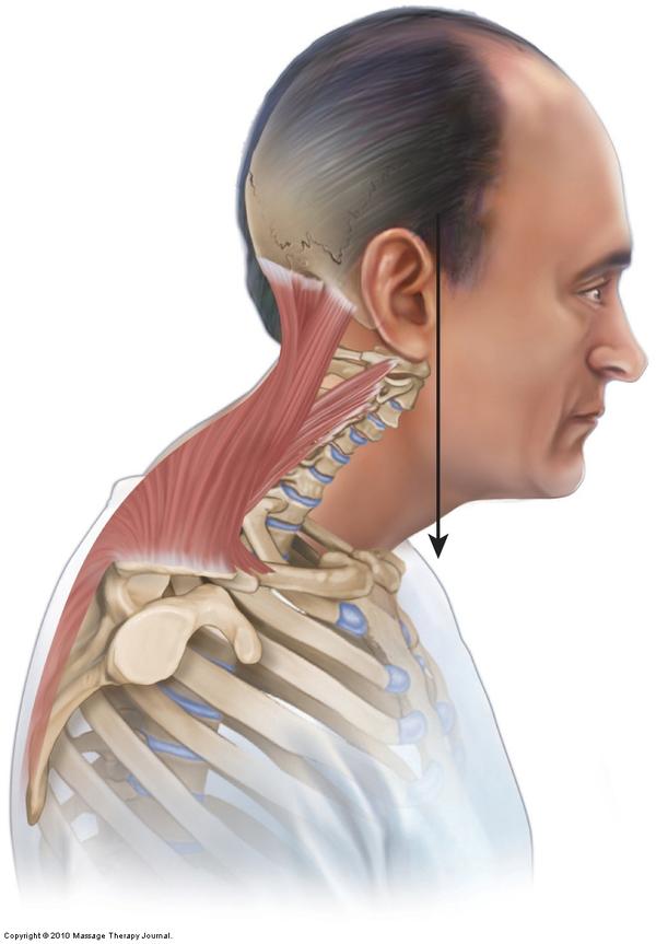 上斜方肌的功能:上提肩胛骨,后缩肩胛骨,使肩胛骨上回旋,使我们的头