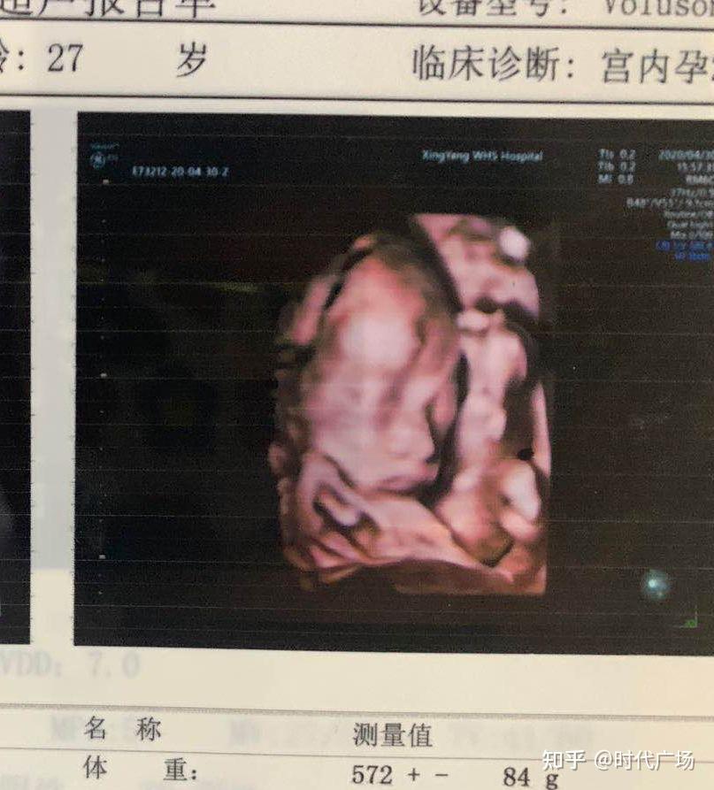 你第一次看到宝宝的四维彩超照片是什么感觉