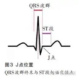 通常j点上下偏移不超过1毫米,大多在等电位线上.