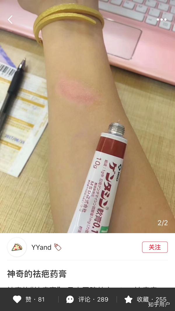十天前腿部烫伤 面积很大 之后感染 至今未结疤 想先求祛疤膏 毕竟