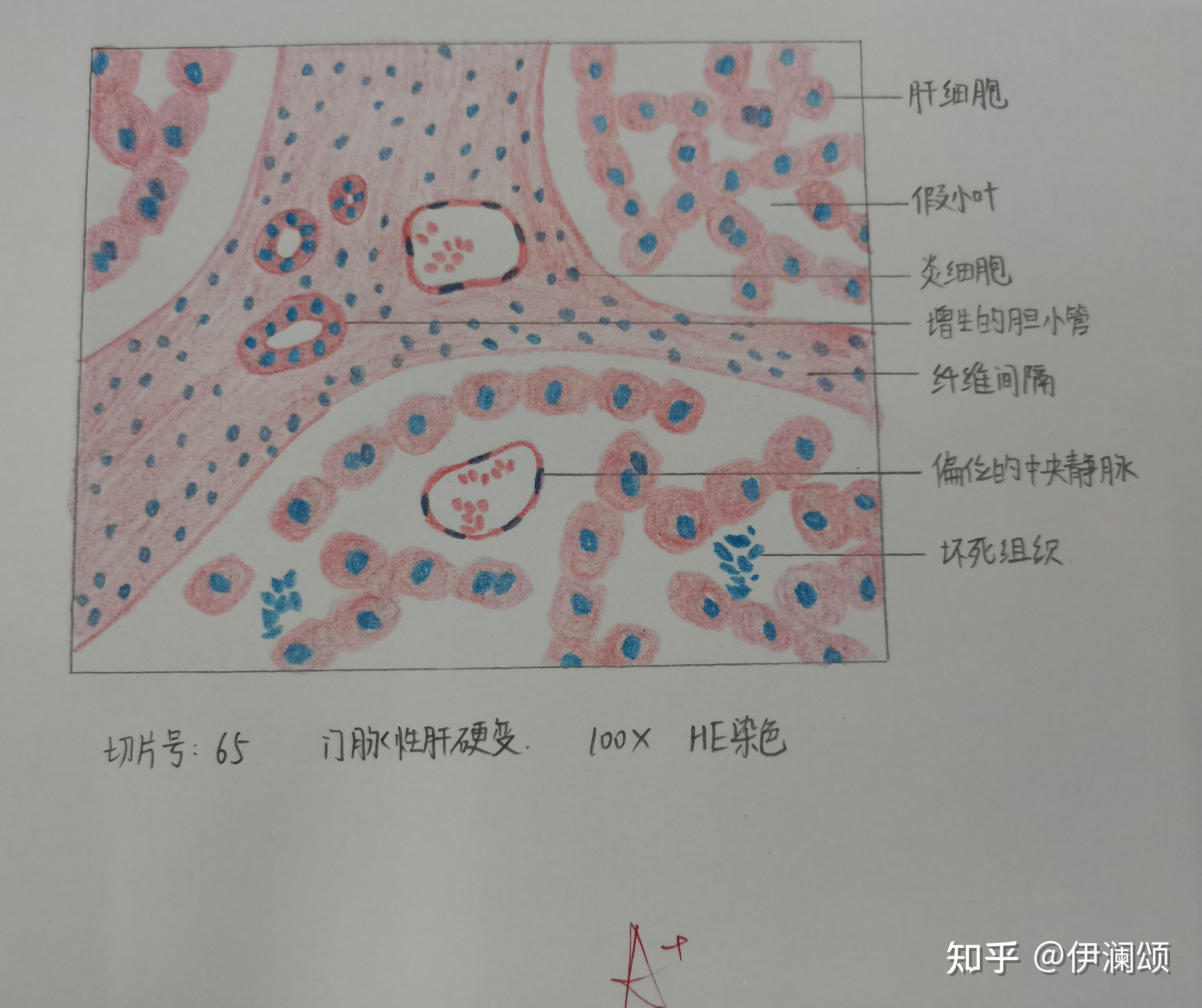 病理实验红蓝铅笔绘图