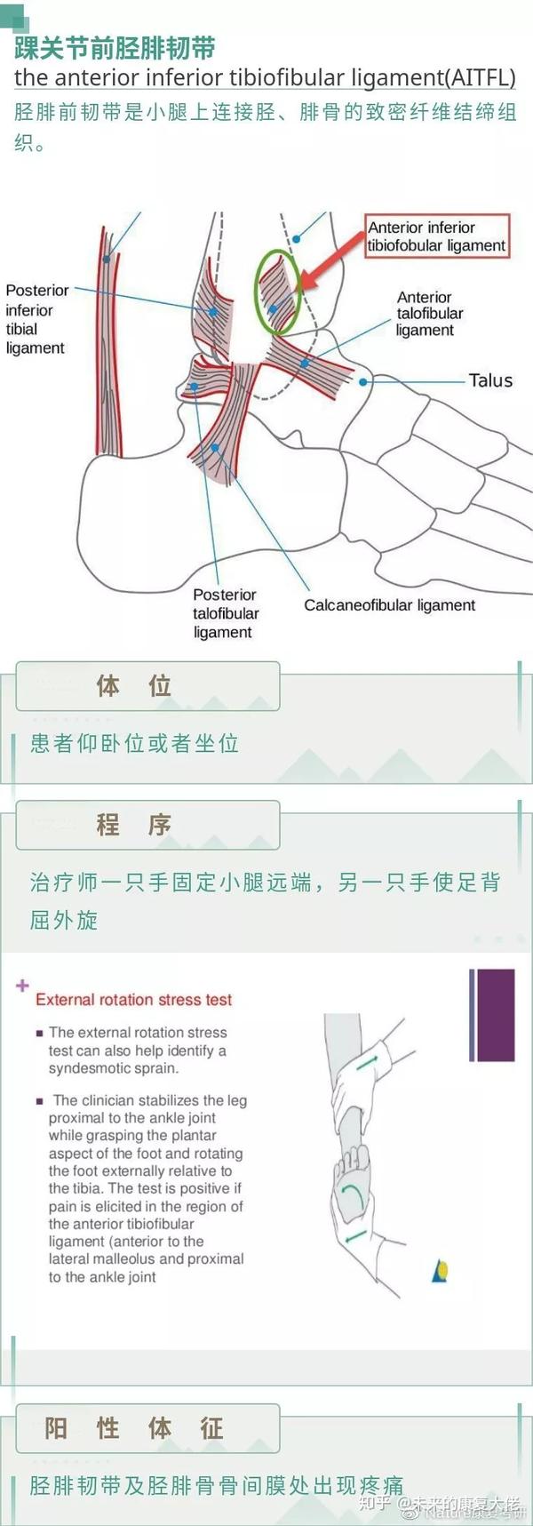 目的:评估跟腓韧带(calcaneofibular ligaments)的完整性 体位:长坐位