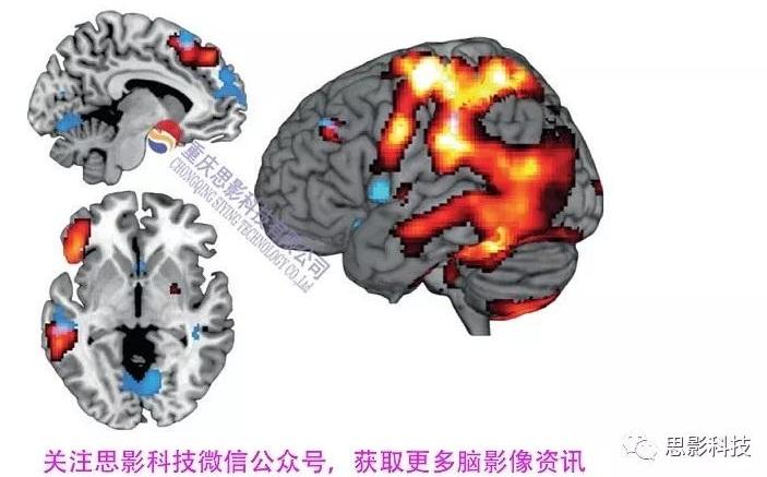 大话脑成像之四浅谈近红外脑功能成像