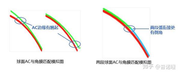 【普诺瞳家族】- 全弧段非球面角膜塑形镜