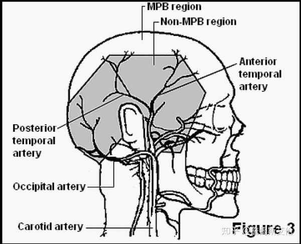他认为侧部和后枕部主血管较多,而头顶离主血管比较远