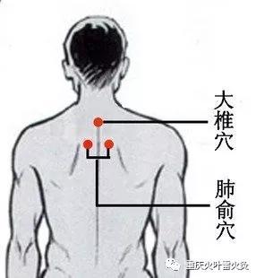 在家如何艾灸预防传染,助力疫情防控(附配穴图)