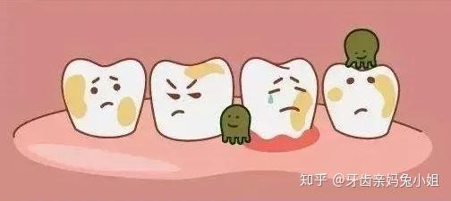 比如: 牙龈出血,牙齿变黄,黑色素加重,有口气,有牙结石.