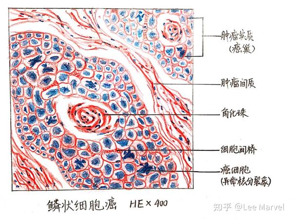 大学病理学红蓝铅笔绘图