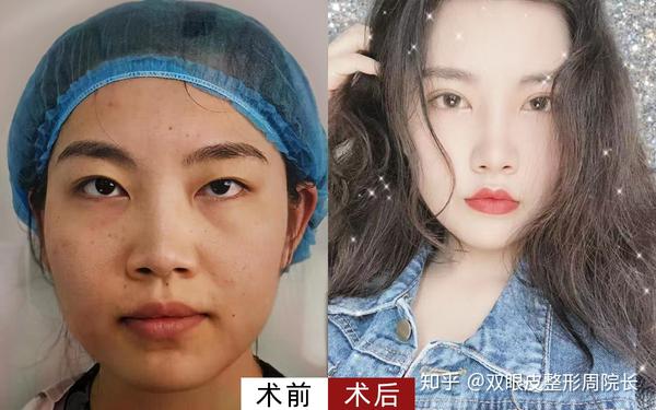 但是很少有人死鱼眼会很好看,现实中的死鱼眼,只会让人看见了问你一句