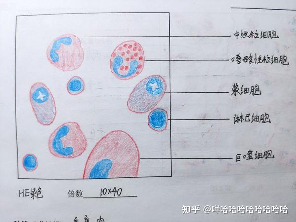 3,各种炎症细胞(注意淋巴细胞细胞膜的颜色与胞质的不同,注意浆细胞的