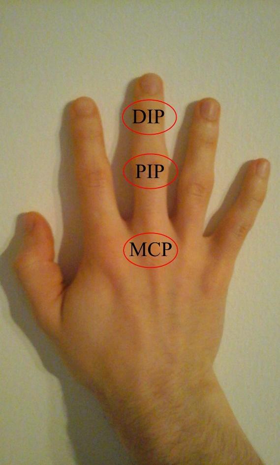 康复第一课手把手教你手指关节rom测量