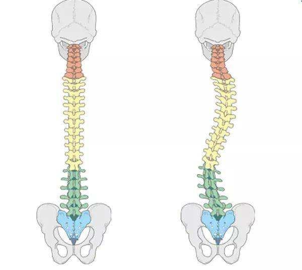 【脊柱侧弯】脊柱力学(上)