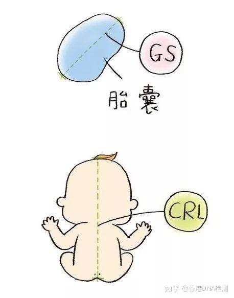 b超的方法测量孕囊(gs-gestational sac 直径或者胎儿的头臀长(crl)