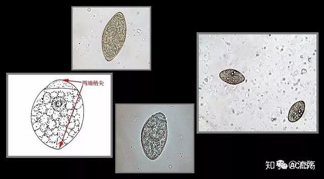 曼氏迭宫绦虫卵旋毛虫幼虫囊包以上文字与图片均摘自公众号[我爱寄生