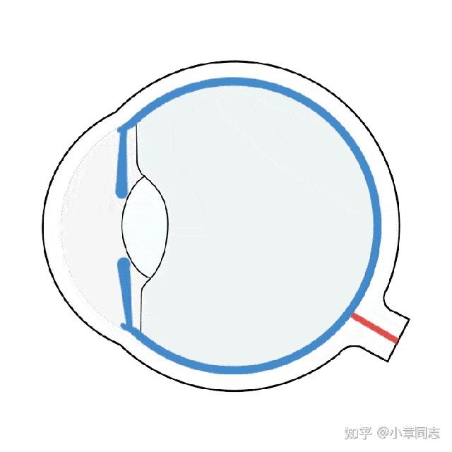屈光参差是指双眼屈光度球镜相差150度,柱镜(散光)相差100度.