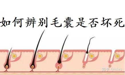 毛囊坏死的症状及图片