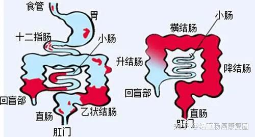 图为:肠道结构图