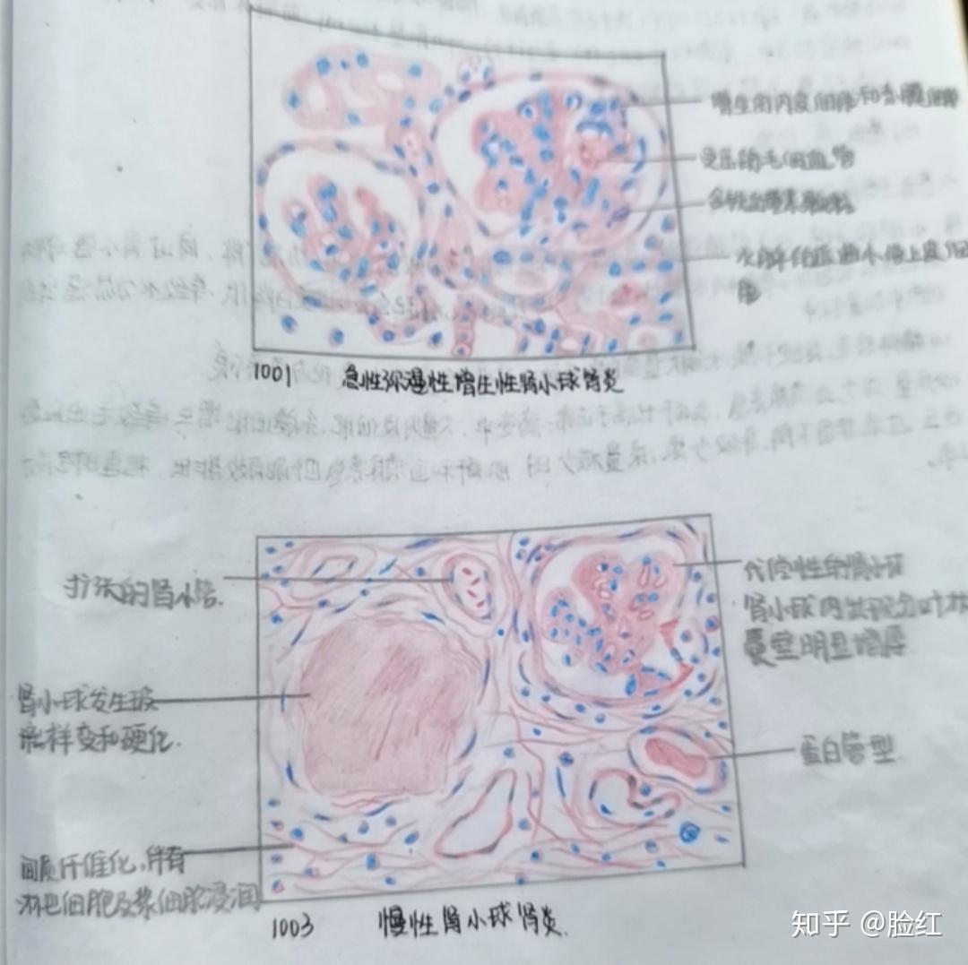 病理学红蓝铅笔绘图