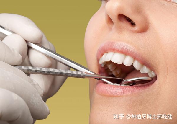 那些人拔牙,危险更大?