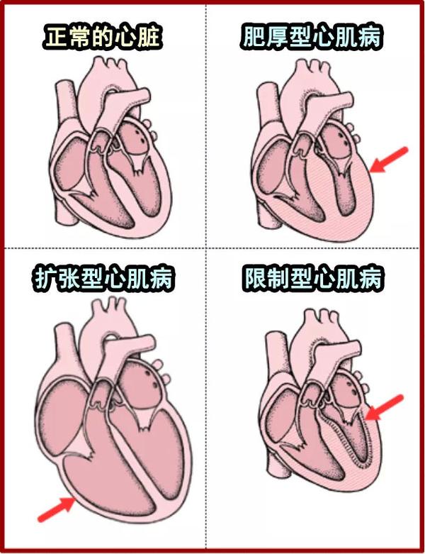 猫心肌疾病示意图图自konekono-heya.com