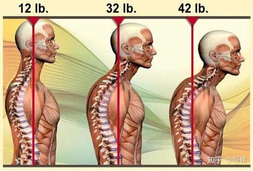 头前引和脊柱压力如图