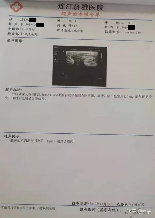 【外科新闻】我院外科顺利完成一例腹腔镜下脐疝修补术!