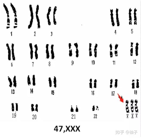2.四倍体:92,xxxx 3.非整倍体(染色体数目不是n的倍数) 4.
