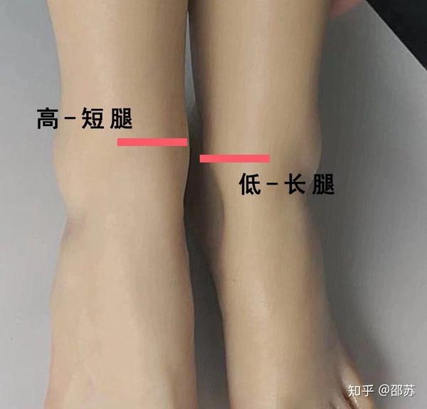 遇到长短腿不用怕,1个动作矫正它!