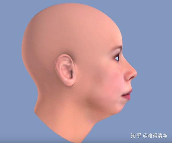 比如 咬合引起的地包天