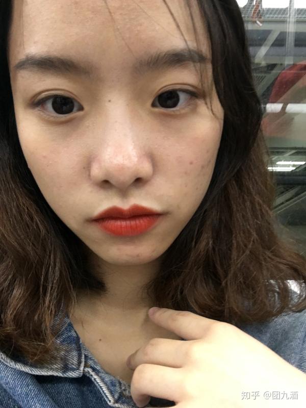 怎么看待五官漂亮但是皮肤差的女性?
