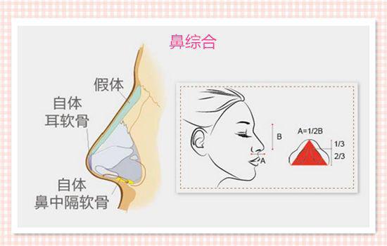 鼻综合手术后如何保持鼻腔卫生